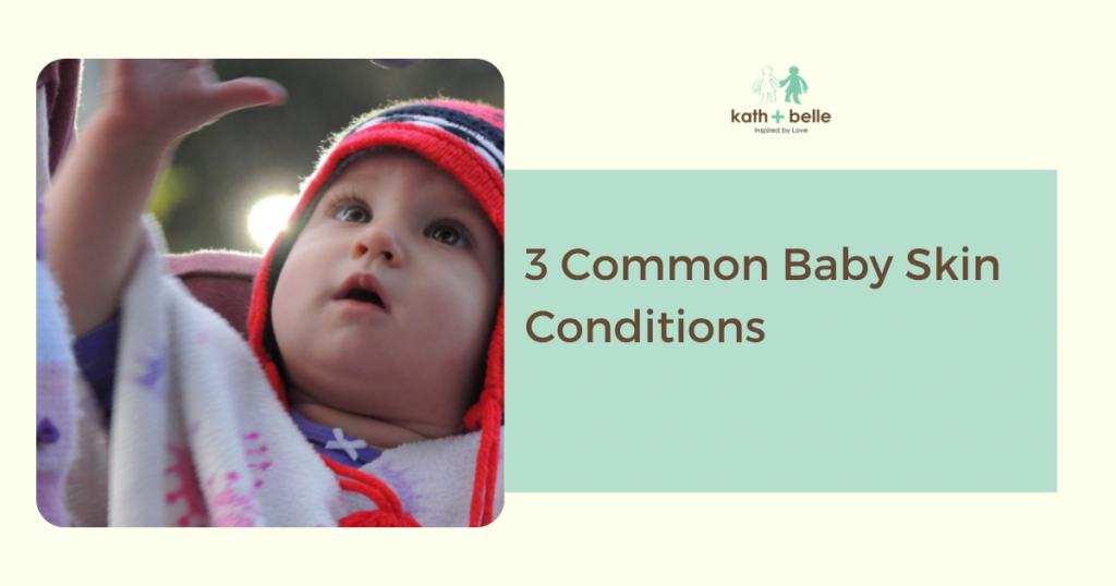 kath + belle sg 3 common baby skin conditions